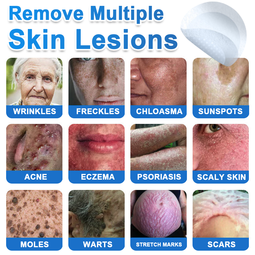 🔥Last Day 80% OFF 👨‍⚕️  Bellevery® 2-in-1 Microneedle & Hydrocolloid Patch | Raised Moles,Acne,  Flat Warts & Skin Tags Remover | Improves Wrinkles, Scars & Blemishes | Invisible Pimple Patches for Face & Body