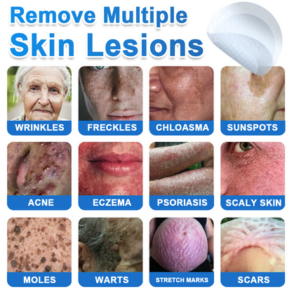 🔥Last Day 80% OFF 👨‍⚕️  Bellevery® 2-in-1 Microneedle & Hydrocolloid Patch | Raised Moles,Acne,  Flat Warts & Skin Tags Remover | Improves Wrinkles, Scars & Blemishes | Invisible Pimple Patches for Face & Body