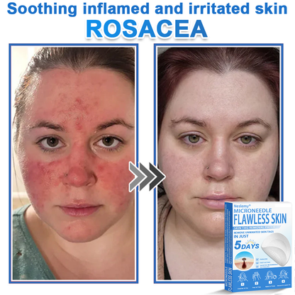 🔥Last Day 80% OFF 👨‍⚕️  Bellevery® 2-in-1 Microneedle & Hydrocolloid Patch | Raised Moles,Acne,  Flat Warts & Skin Tags Remover | Improves Wrinkles, Scars & Blemishes | Invisible Pimple Patches for Face & Body