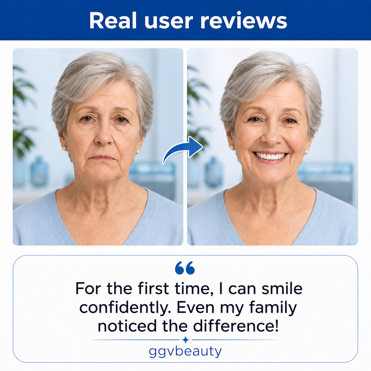 Custom—Fit Dentures for Everyday Comfort