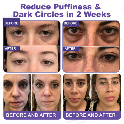 ✨Bellevery® PDRN Renewal Complex Eye Cream