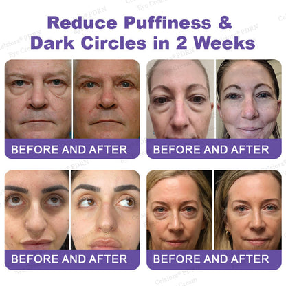✨Bellevery® PDRN Renewal Complex Eye Cream