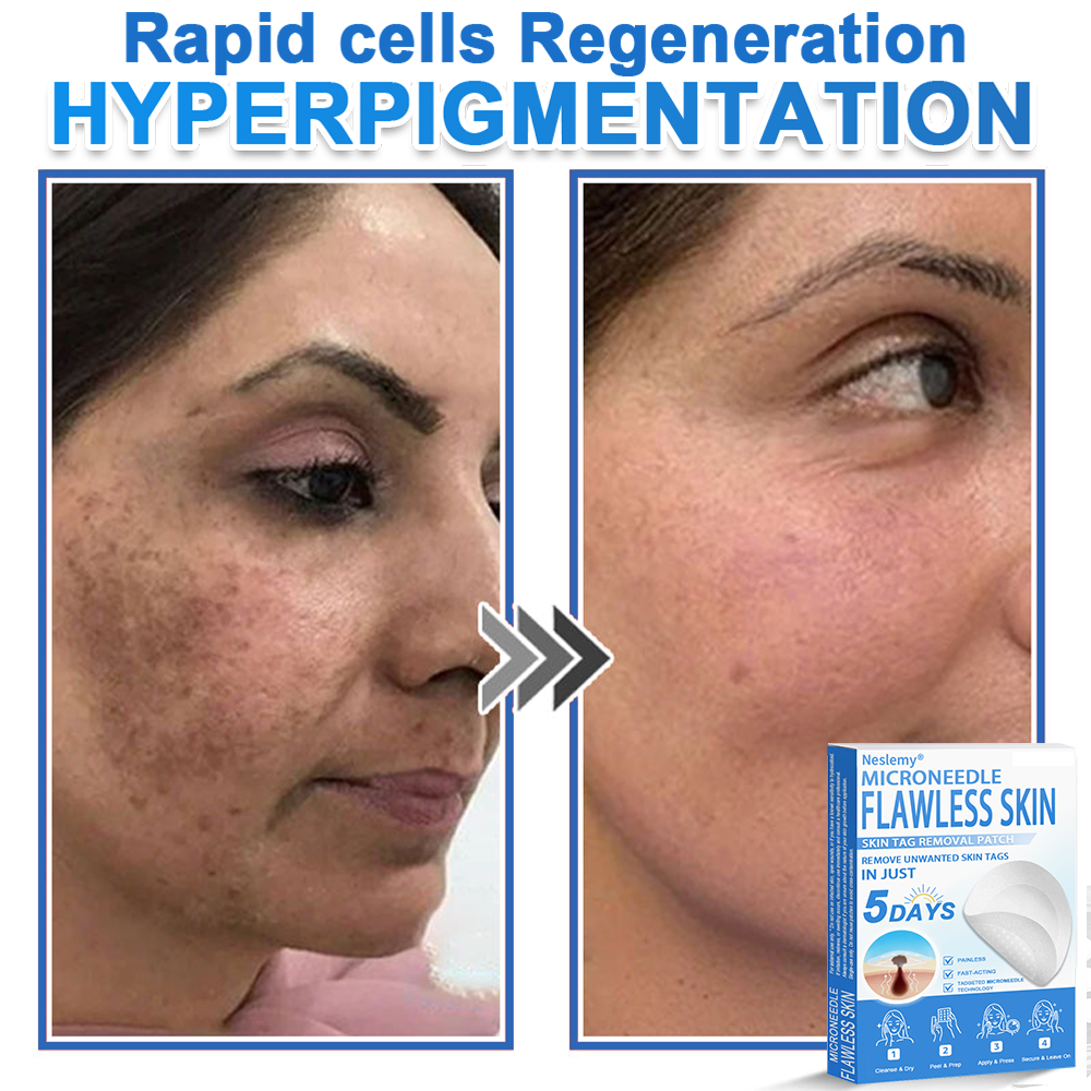 🔥Last Day 80% OFF 👨‍⚕️  Bellevery® 2-in-1 Microneedle & Hydrocolloid Patch | Raised Moles,Acne,  Flat Warts & Skin Tags Remover | Improves Wrinkles, Scars & Blemishes | Invisible Pimple Patches for Face & Body