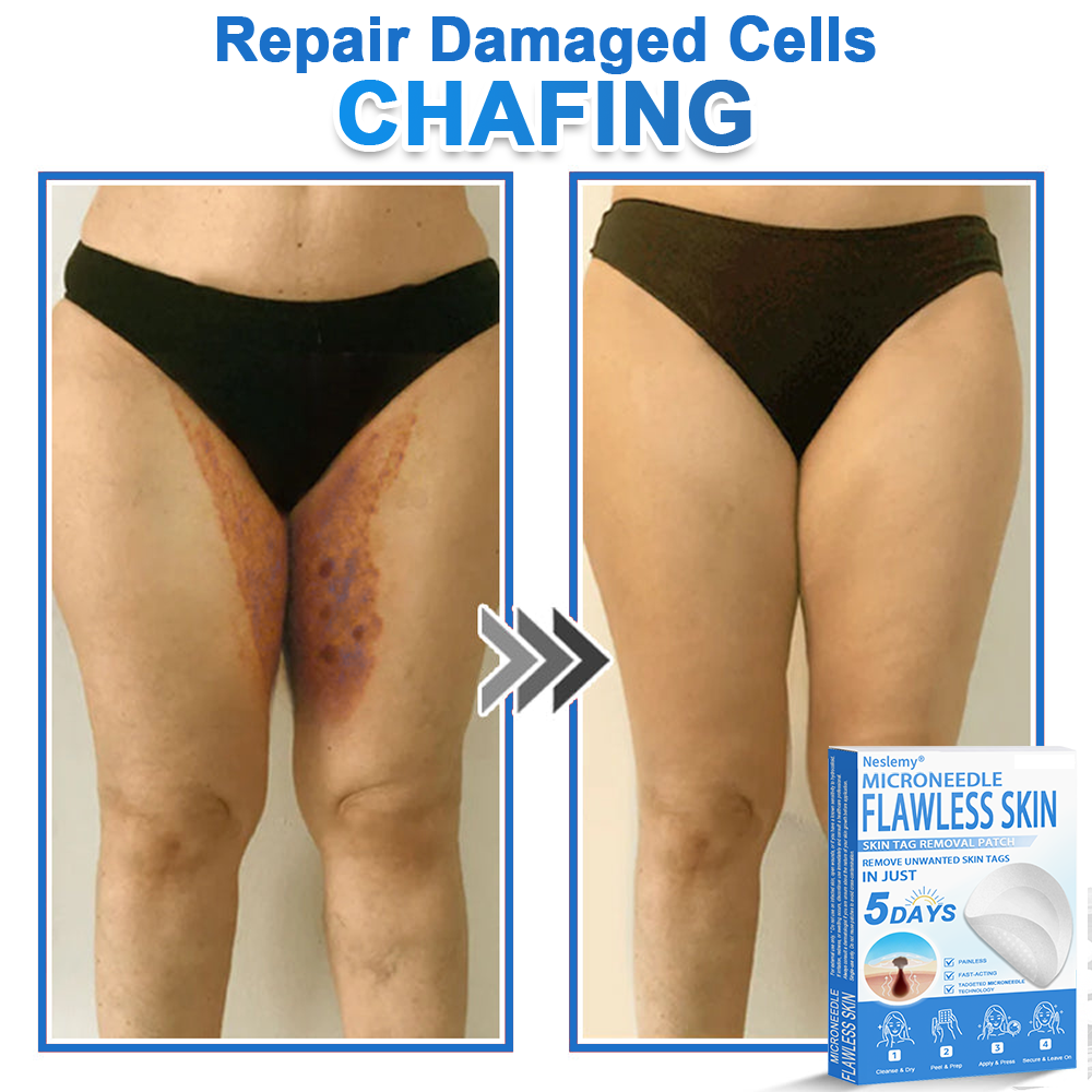 🔥Last Day 80% OFF 👨‍⚕️  Bellevery® 2-in-1 Microneedle & Hydrocolloid Patch | Raised Moles,Acne,  Flat Warts & Skin Tags Remover | Improves Wrinkles, Scars & Blemishes | Invisible Pimple Patches for Face & Body