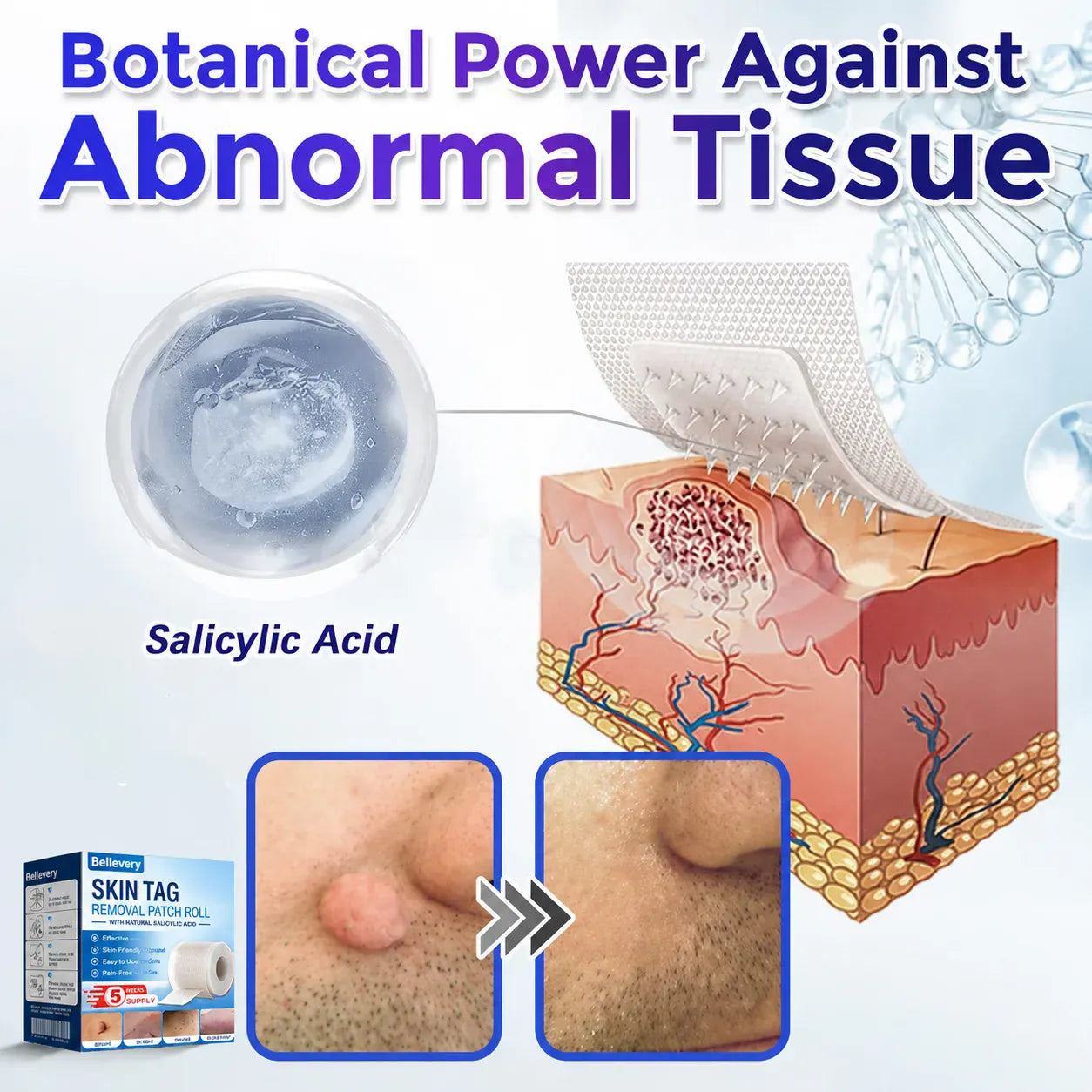 🍁🌟Bellevery® Multi-Functional Microneedle Hydrocolloid Patch Roll | Targets Skin Tags, Warts & Stubborn Blemishes