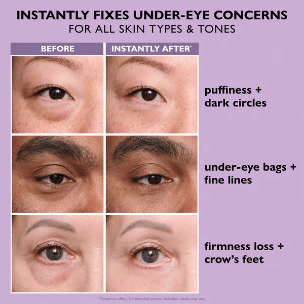🛩️FLASH SALE/🌸Instant Eye Tightener Easy-Wear Formula – Ultimate Lift & Smooth Finish ✨