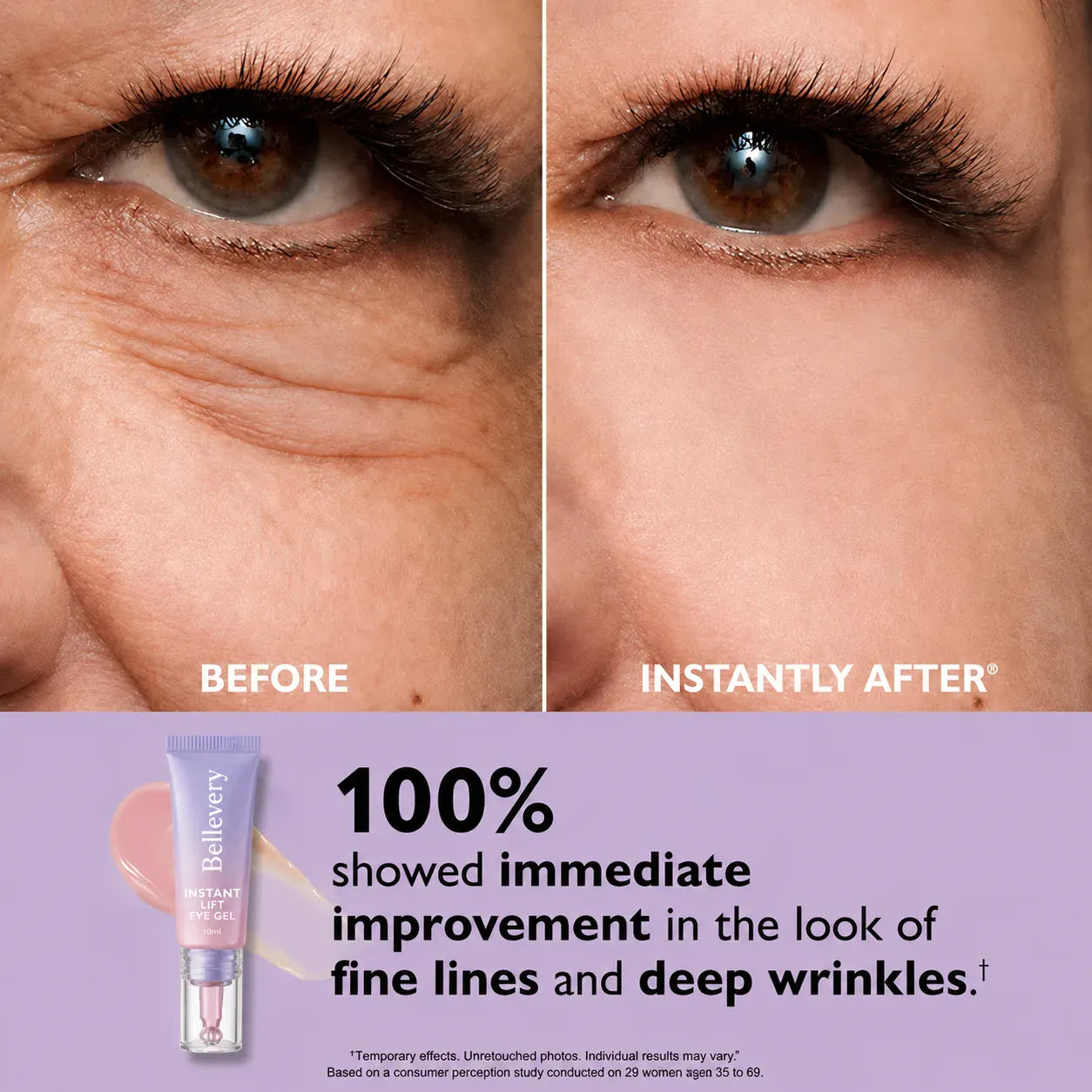 Fempick Eye Bag Instant Eraser, Tightens, Firms, & Blurs Wrinkles