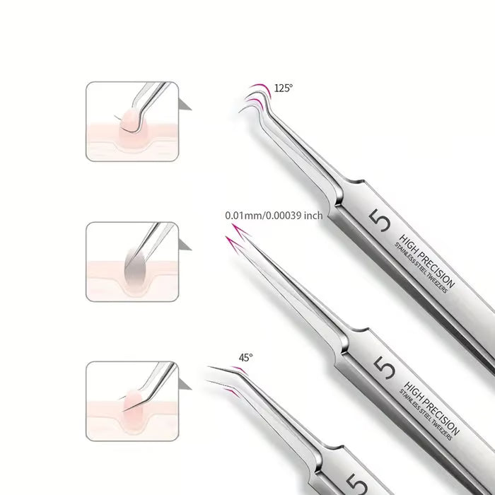 HOT SALE 49% OFF💥Professional Facial Blackhead Remover Tweezers