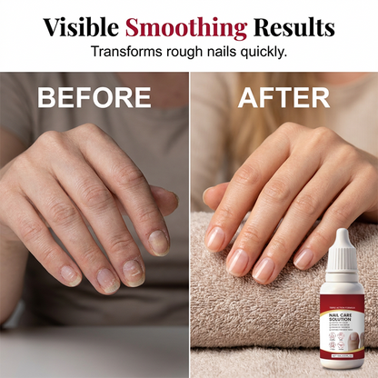 🔥Last Day 50% OFF 👨‍⚕️  Triple Action Nail Care Repair Solution Kit